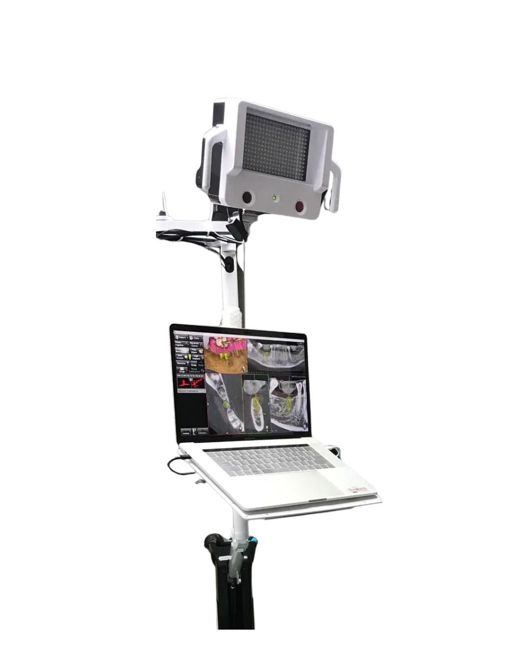 Navident 3.0 product