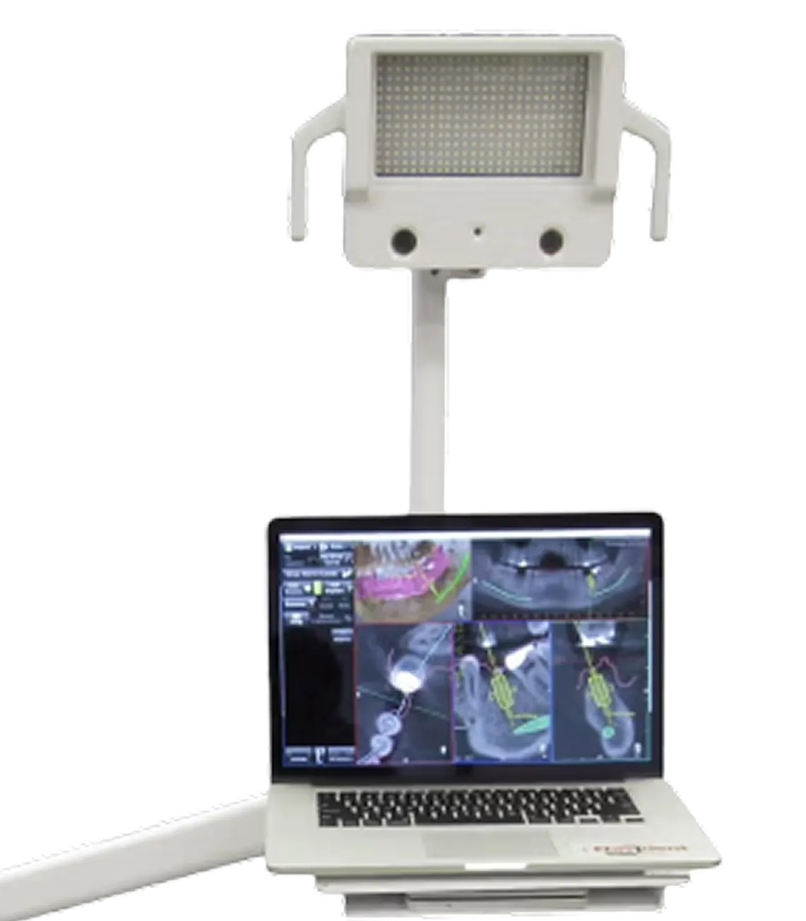 Navident 3.0 navigation system device