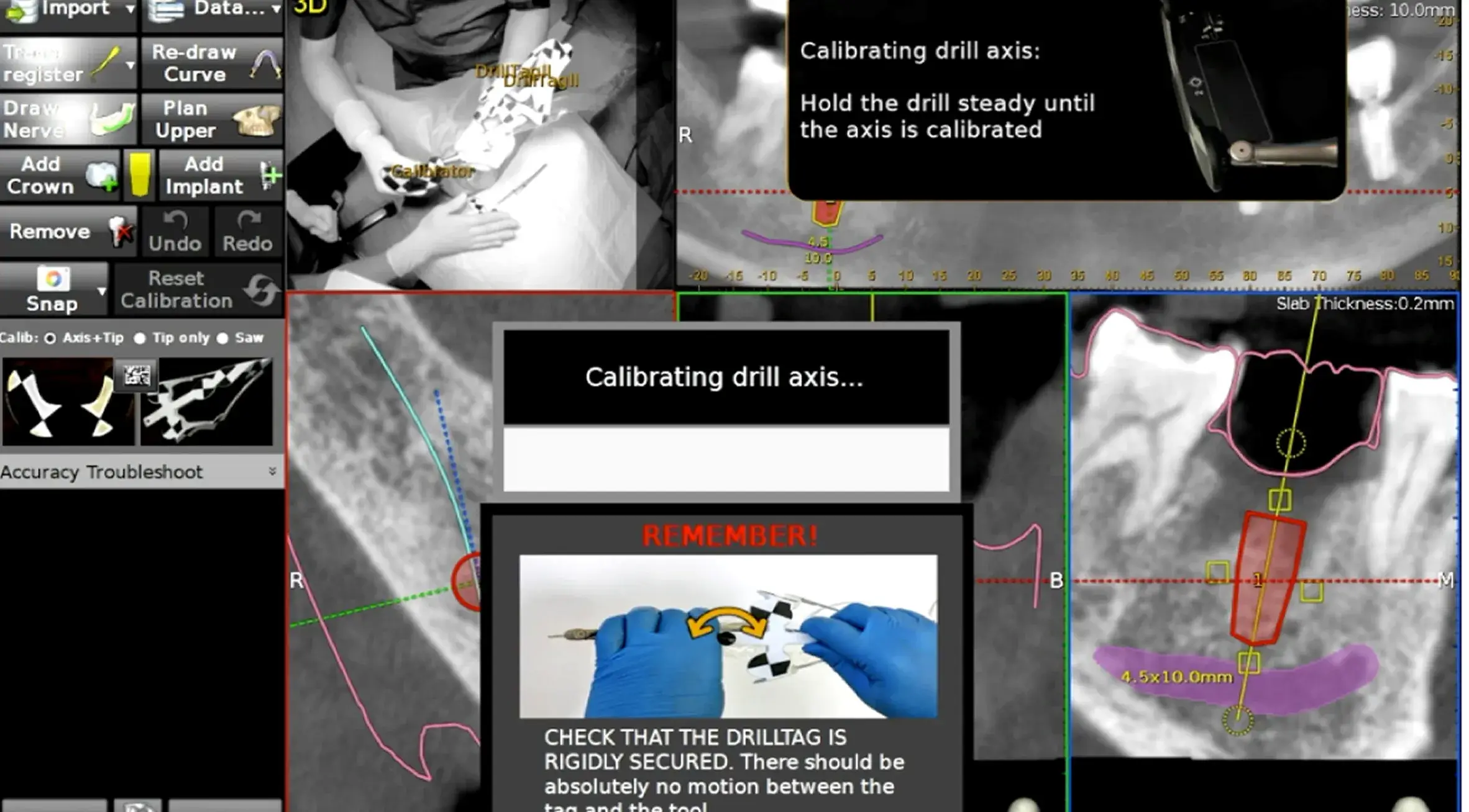 Case study 10